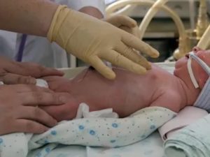 Если из за халатности врачей ребенок родился мертвым