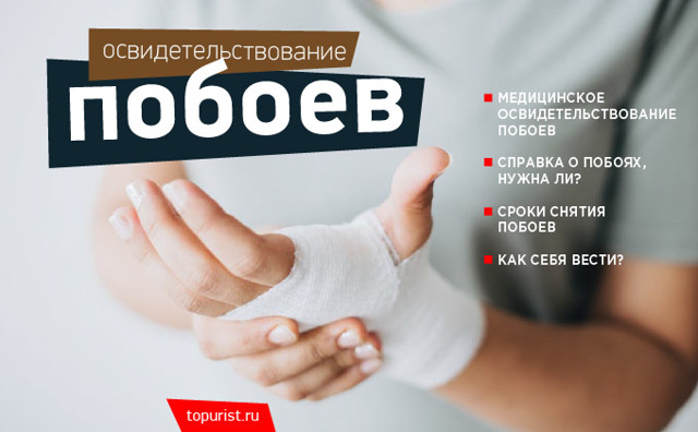 Как снять побои &mdash; заявление о побоях в полицию, сроки
