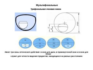 Как вернуть очковые линзы